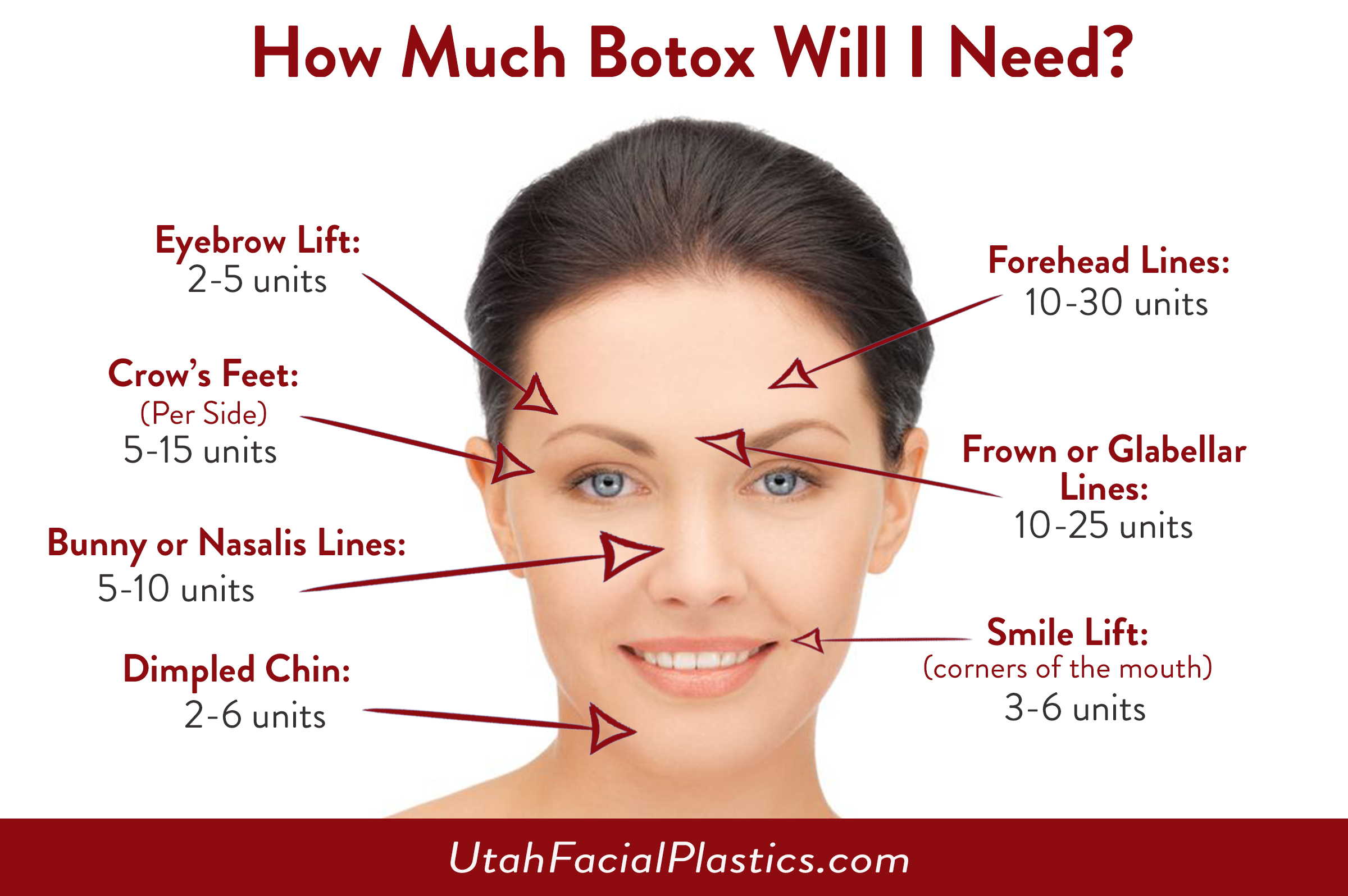 How much botox will you need
