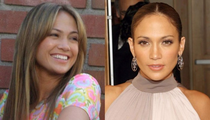 jlo before and after versace