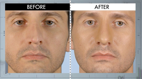 What We Can Learn From E's New Plastic Surgery Show, "Botched"