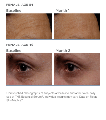 tns-essential-serum-beforeafter-01 tns-essential-serum-beforeafter-01