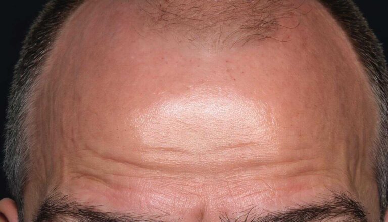 seamless natural hairline