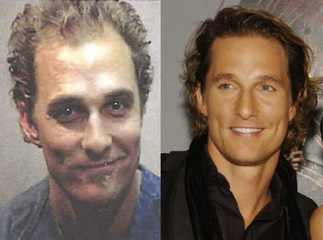 Matthew McConaughey Hair Transplant-1