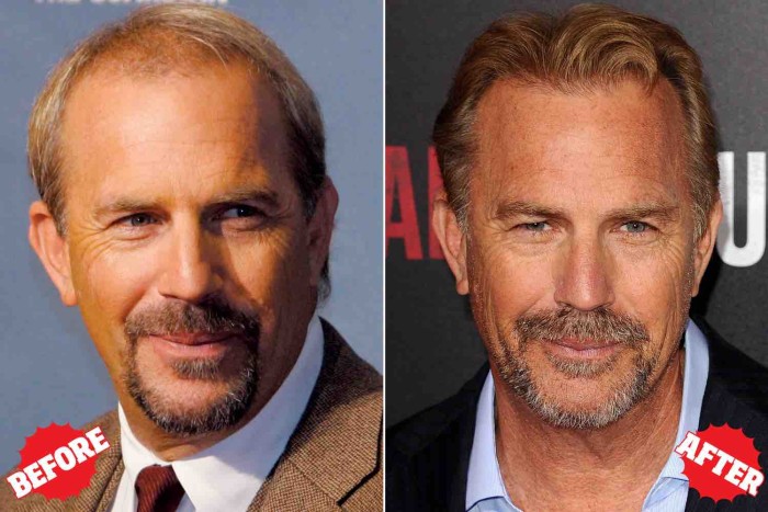 hair_costner_before_after1a