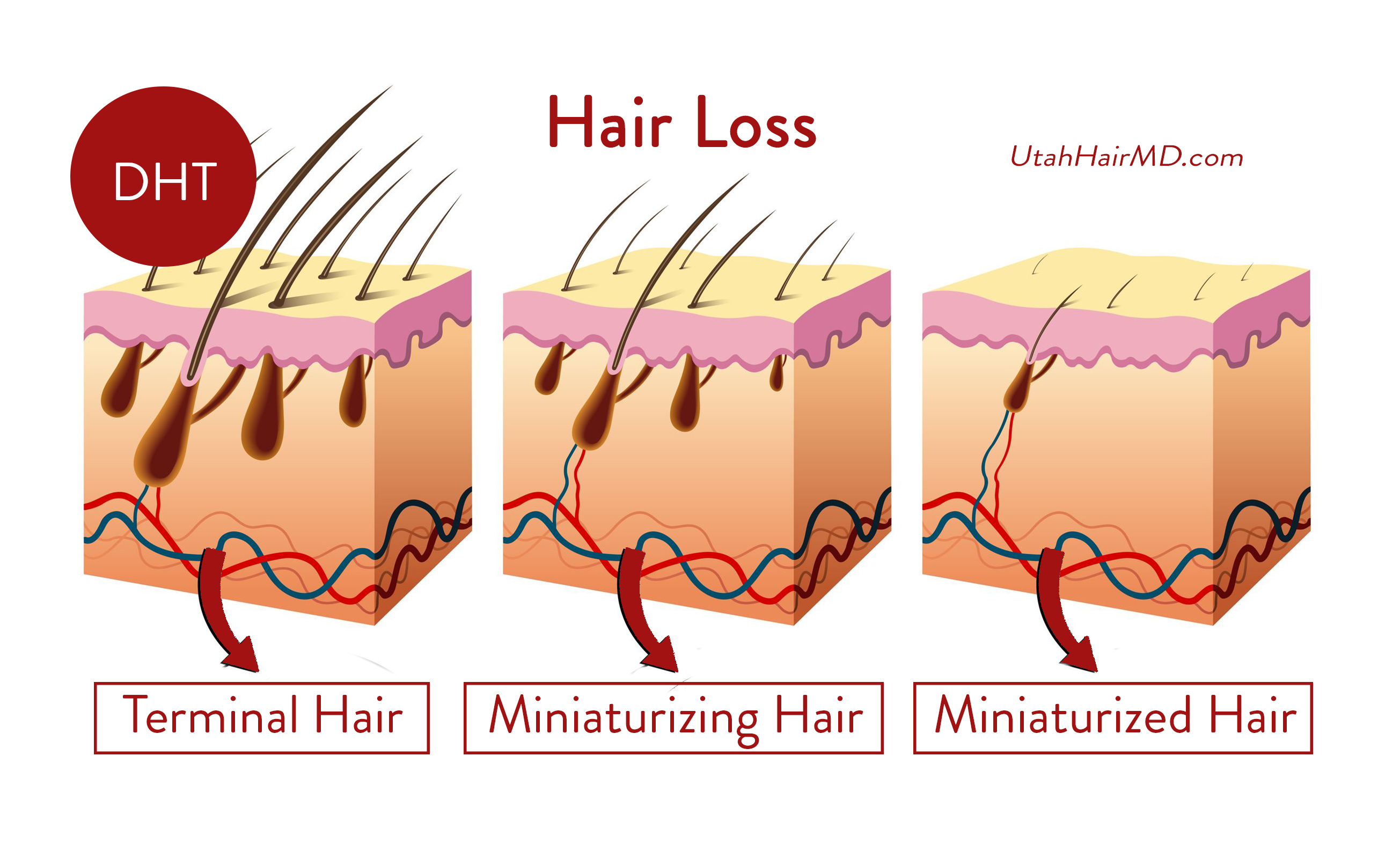 PRP For Hair Loss Q A