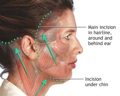 neck diagrams full neck diagrams full