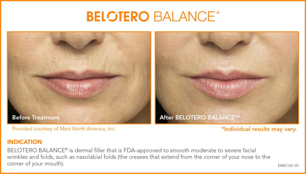 EM01161-01-BELOTERO_E-mediaKit_BA_Rolana