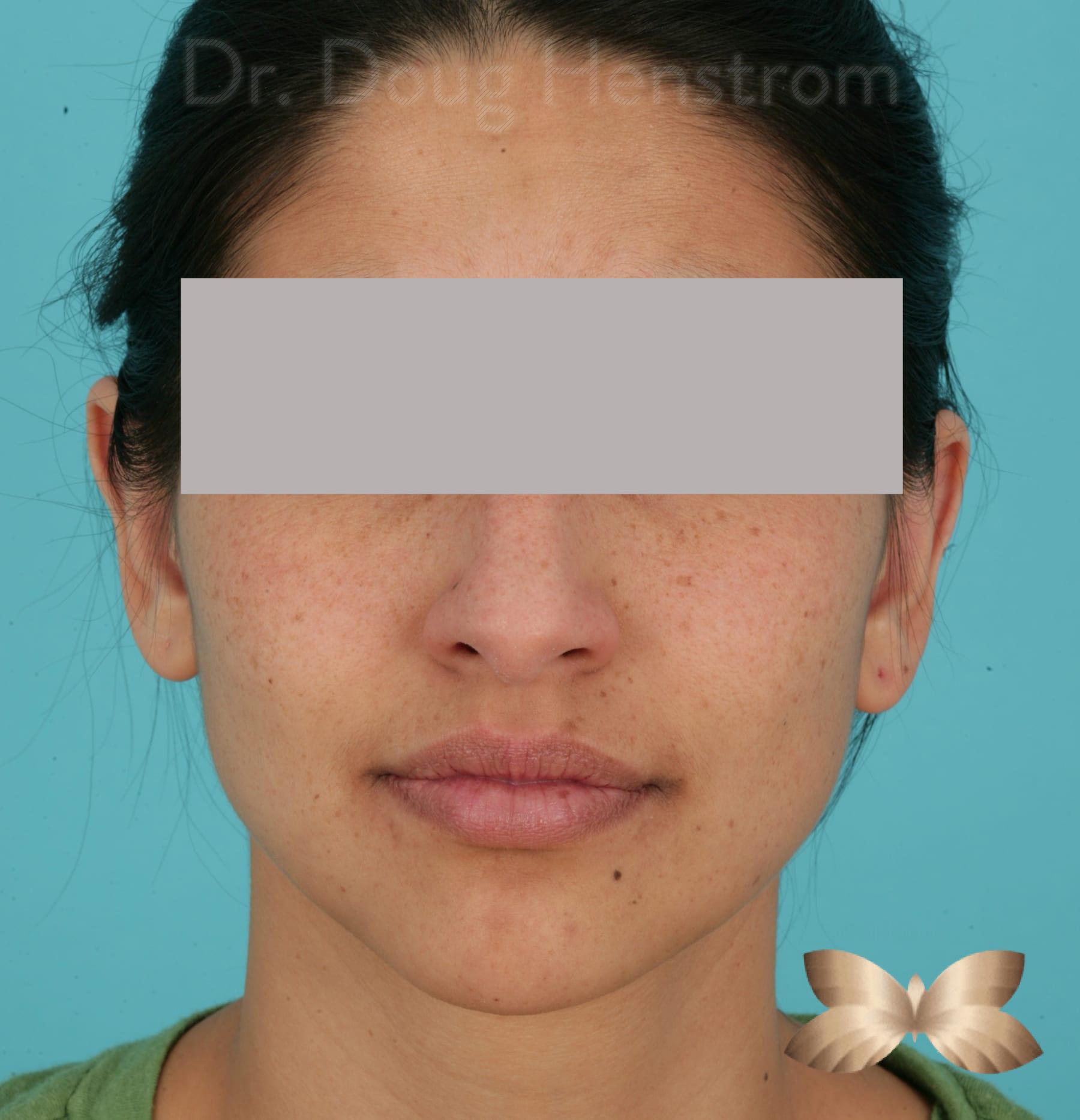 After Image