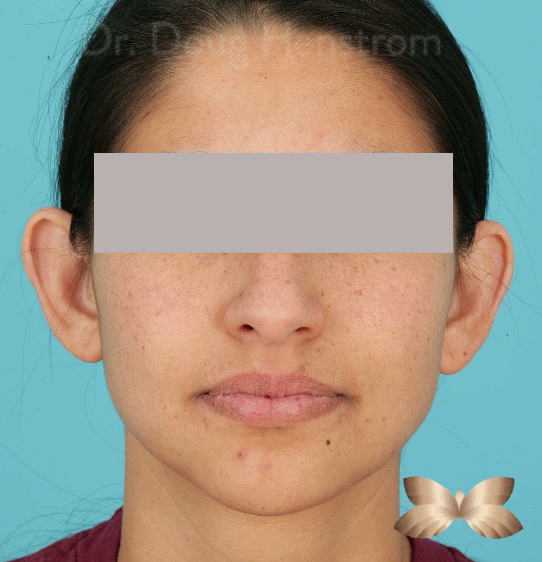Before Image