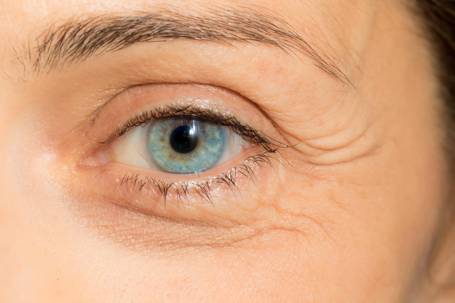 Three Different Types of Eyelid Surgeries Utah Facial Plastics