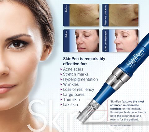 skin pen skin pen