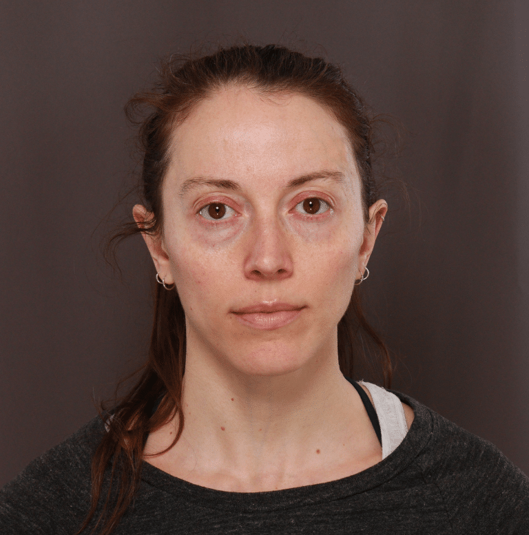 Utah Facial Plastics