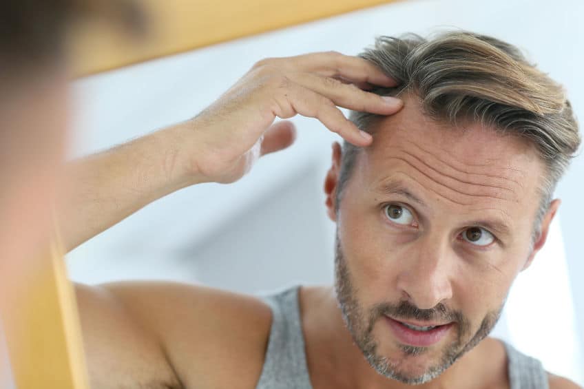 46410961 - hombre de mediana edad preocupado por la caída del cabello