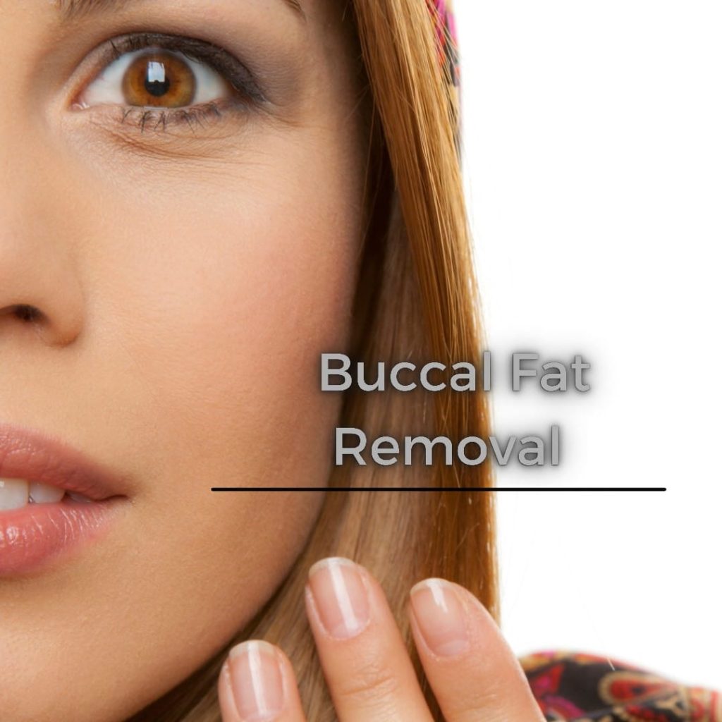 Buccal Fat