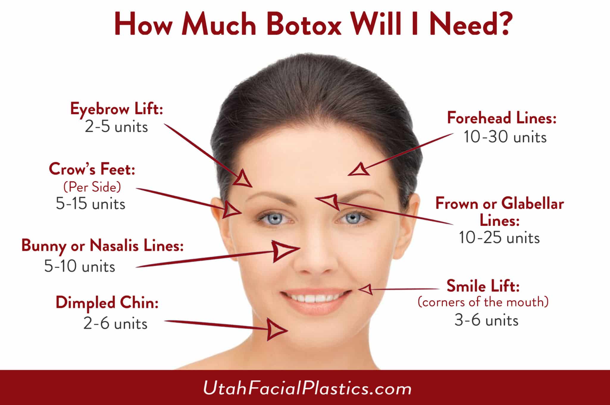 How much botox will i need