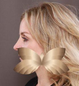 After Image: Rhinoplasty by: Dr. Henstrom