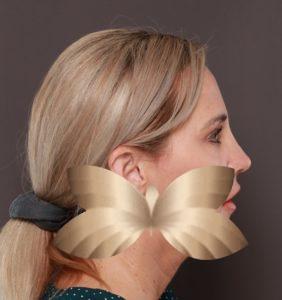 After Image: Rhinoplasty by: Dr. Henstrom