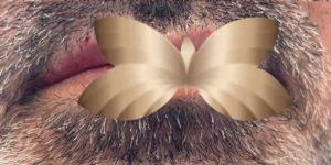 After Image: Lip Augmentation by: Nurse Injector