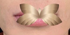Before Image: Lip Augmentation by: Jeanna