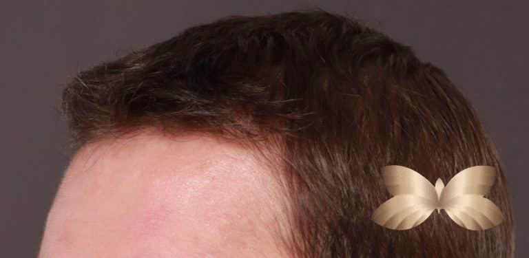 After Image