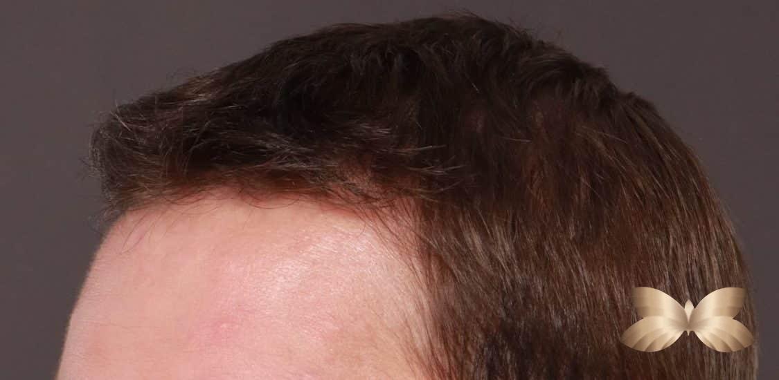 After Image