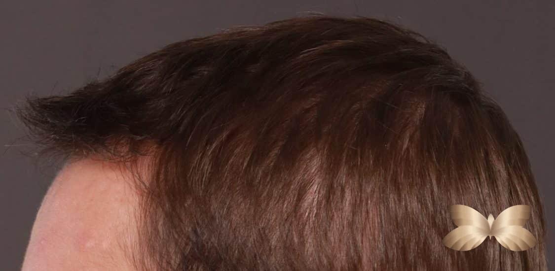 After Image