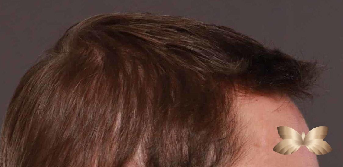 After Image