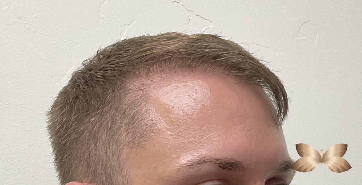 After Image