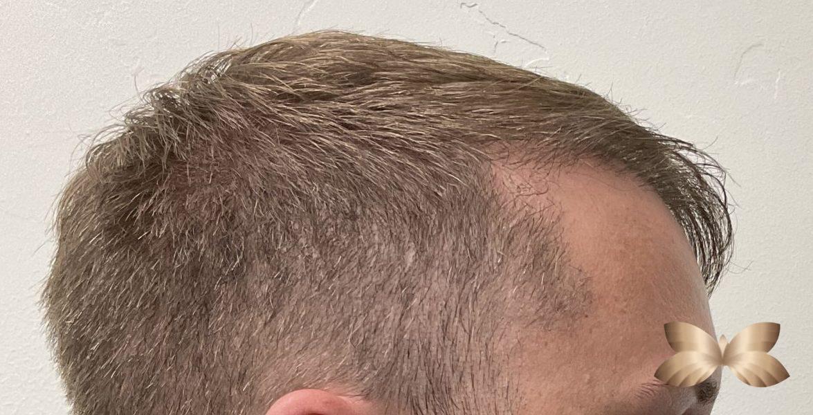 After Image