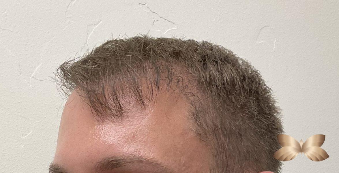 After Image