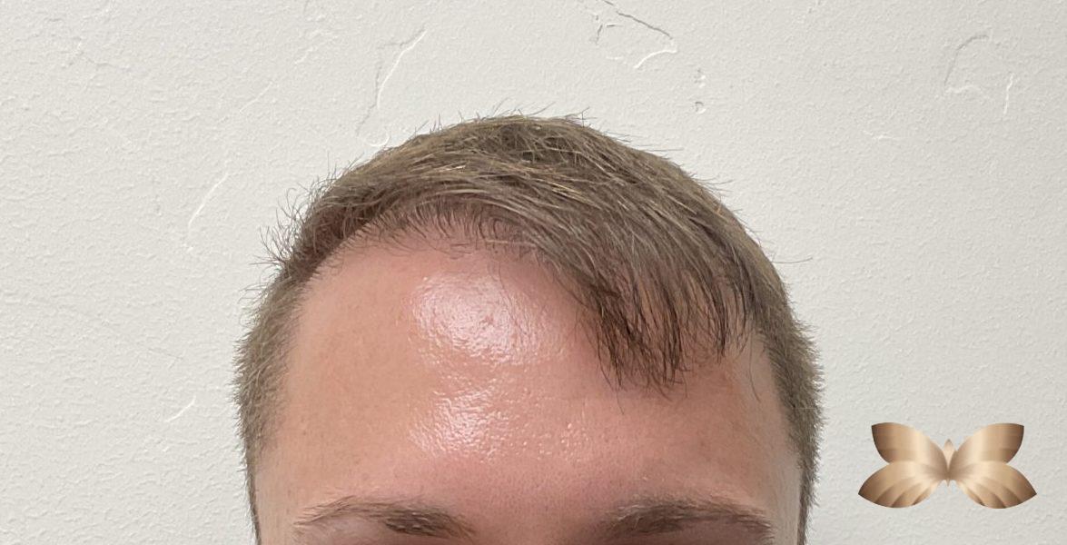 After Image