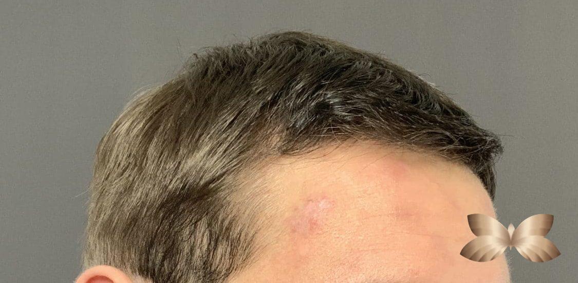 Before Image
