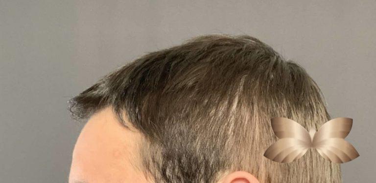 Before Image