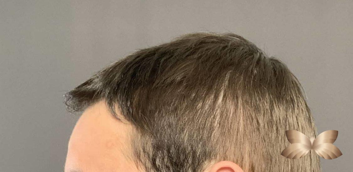 Before Image