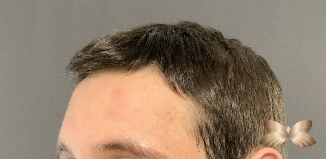 Before Image