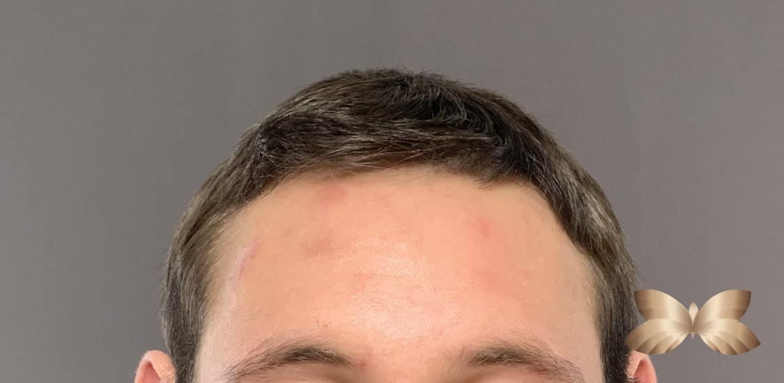 Before Image