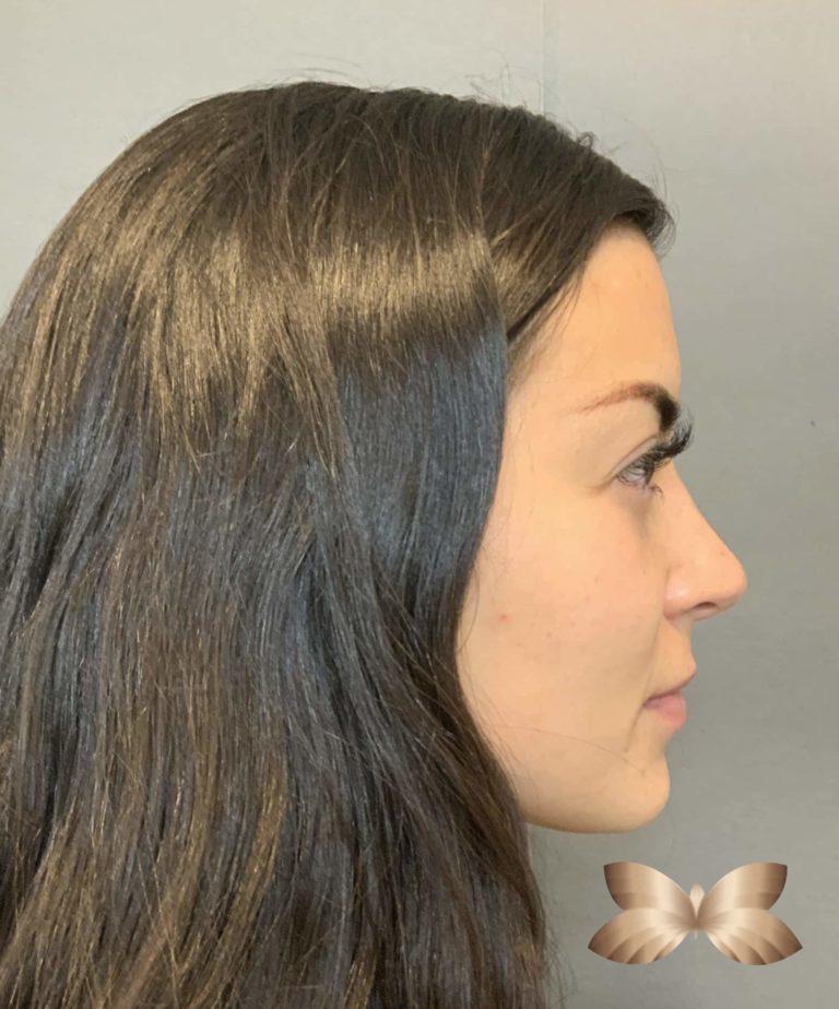Before Image