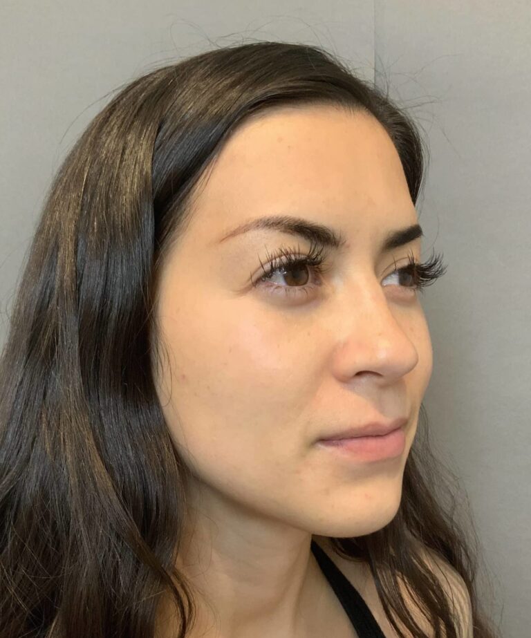 Before Image
