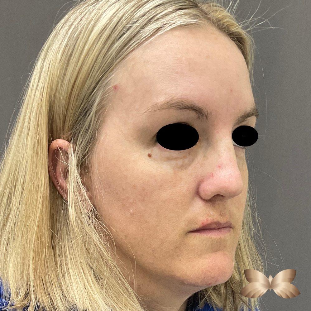 After Image