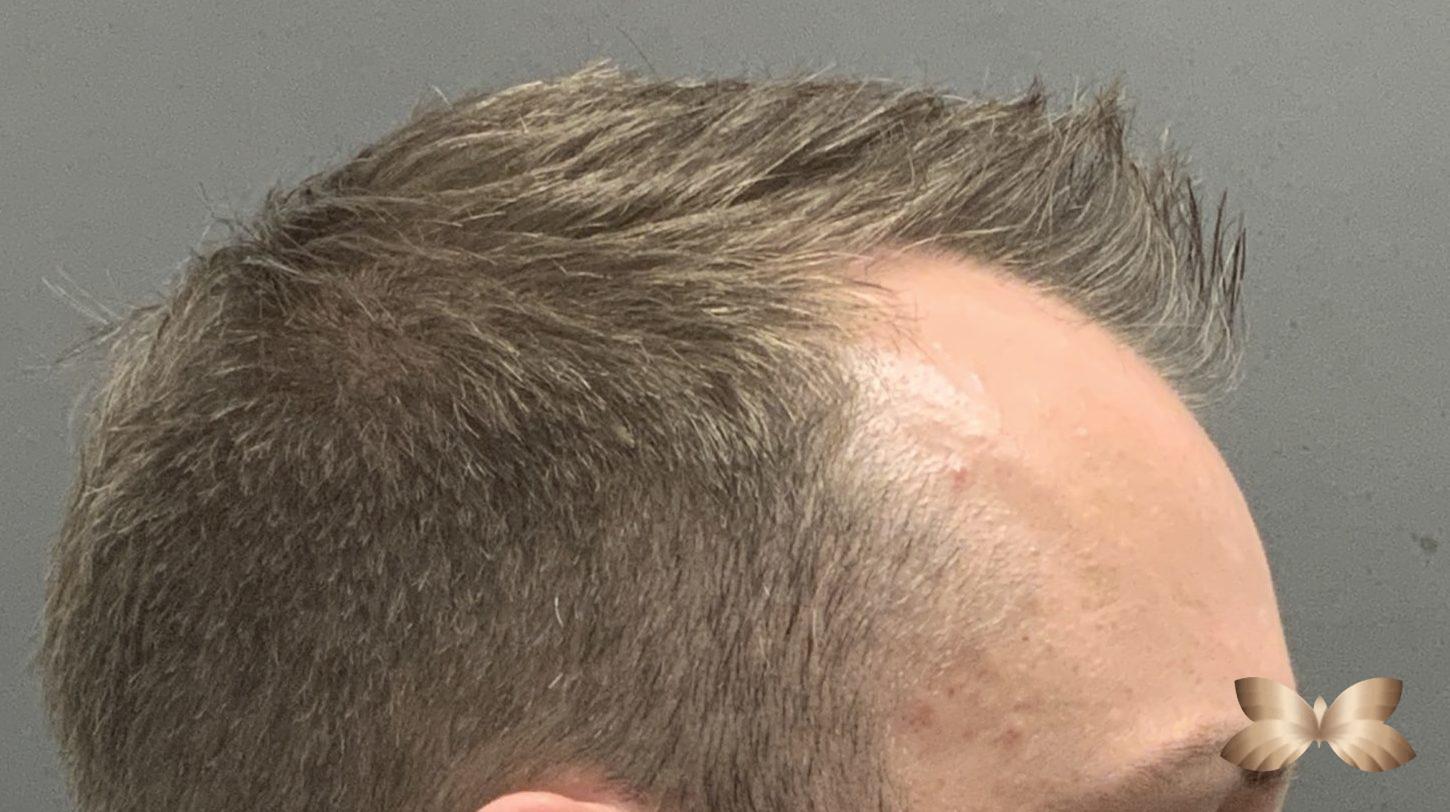 Before Image