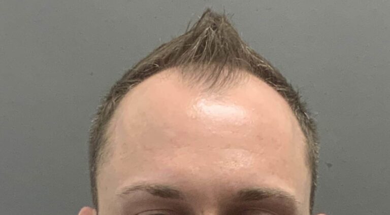 Before Image