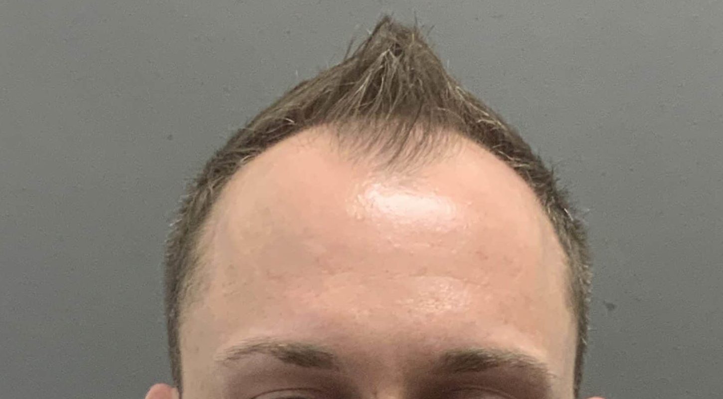 Before Image
