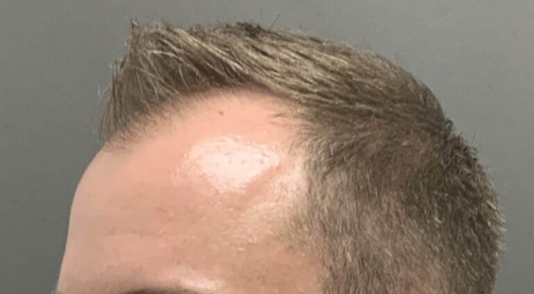 Before Image