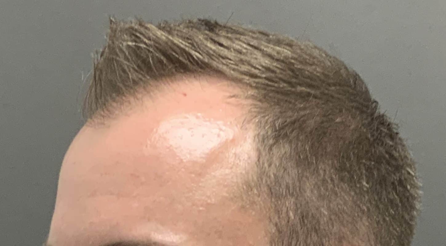 Before Image