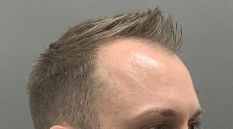 Before Image