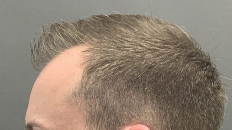 Before Image