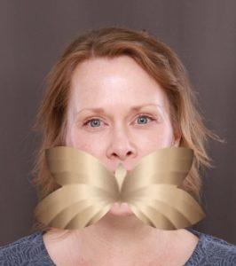 After Image: Facelift, Upper Eyelid Lift, Lower Skin Pinch and Fat Grafting by: Dr. Thompson