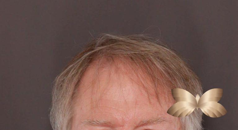Before Image