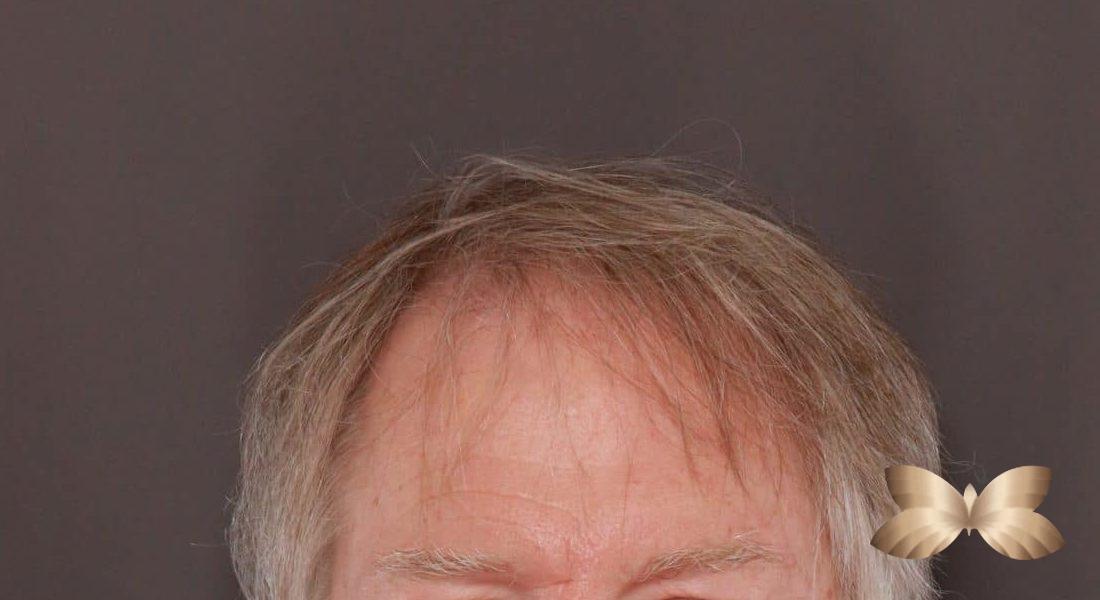 Before Image