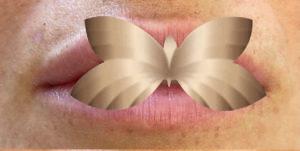 Before Image: Lip Augmentation by UFP Nurse Injector