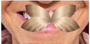 Before Image: Lip Augmentation by: Jeanna